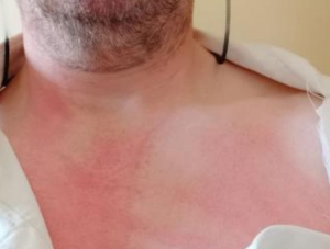 Un preso agrede a un funcionario de El Acebuche durante un cacheo