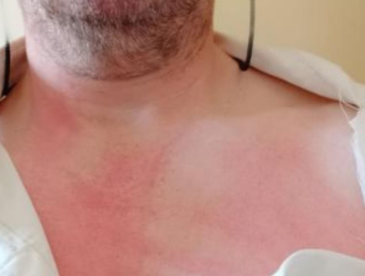 Un preso agrede a un funcionario de El Acebuche durante un cacheo