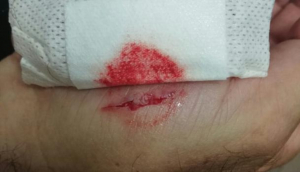 Un preso muerde en una mano a un funcionario en Puerto III