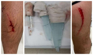 Denuncian una brutal agresi&oacute;n a cuatro funcionarios de la c&aacute;rcel de Alboc&agrave;sser