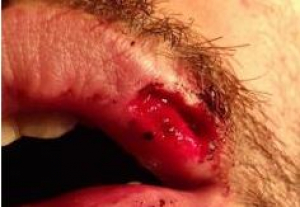 Violenta agresi&oacute;n de un interno a un funcionario en la c&aacute;rcel de Menorca