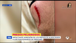 Reportaje Antena 3 agresi&oacute;n a funcionarios en C.P Albocasser