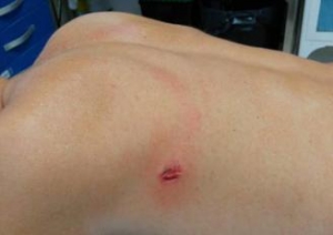 AGRESI&Oacute;N A DOS FUNCIONARIOS EN FONTCALENT.