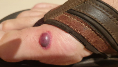 Funcionarios de prisiones denuncian chinches en Valdemoro